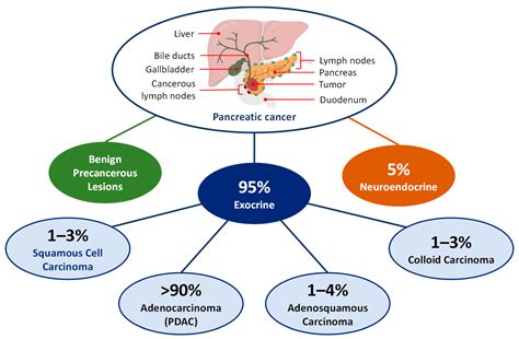 Targeted Nanoparticle-Based Diagnostic and Treatment Options for Pancreatic Cancer