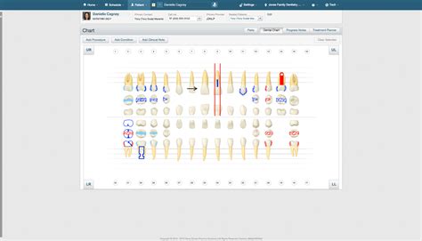Dentrix Ascend Reviews, Prices & Ratings | GetApp UK 2026