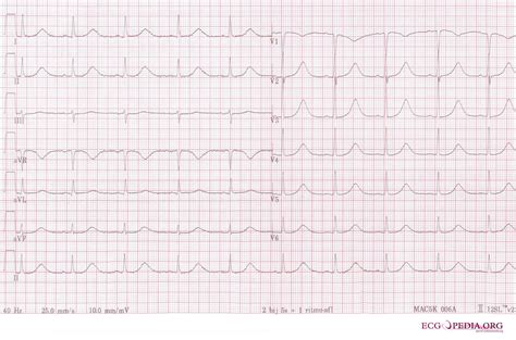 Episode 10: The Pharmacist and the ECG Should Be Friends - Pharmacy Joe