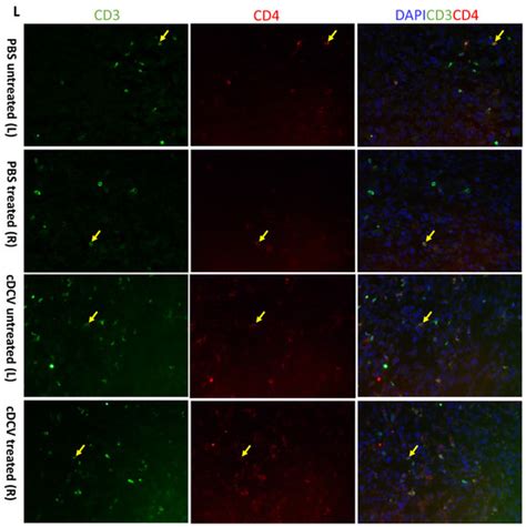 CD103+ cDC1 Dendritic Cell Vaccine Therapy for Osteosarcoma Lung Metastases