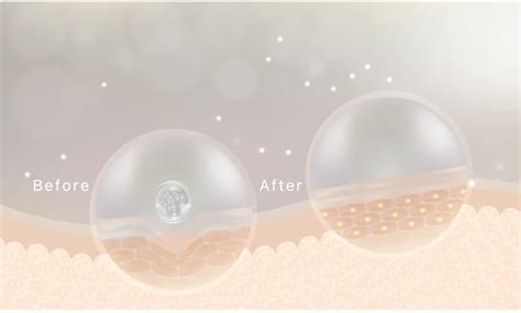 Best Stretch Marks Removal Cream for Women & Men | ThriveCo