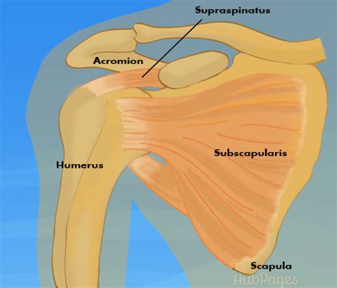 Shoulder Injuries: Rotator Cuff Pain and Treatment - HubPages