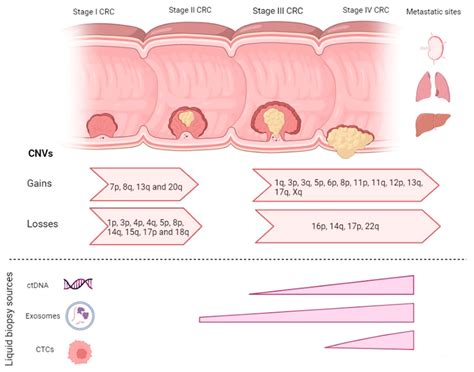 Copy Number Variations as Determinants of Colorectal Tumor Progression ...