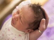 Hair Growth Newborn Babies by Do Newborn Babies Suffer From Hair Loss Boldsky Hair Growth Newborn Babies