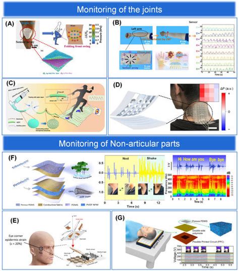 Biosensors | Special Issue : Epidermal Electronics and Implantable Devices