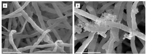 Fungal–Lactobacteria Consortia and Enzymatic Catalysis for Polylactic ...