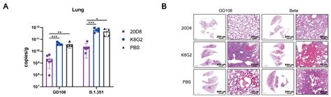 Development of an ELISA Assay for the Determination of SARS-CoV-2 ...