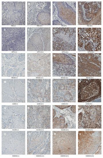 IJMS | Special Issue : Squamous Cell Cancer of the Head and Neck—Time ...