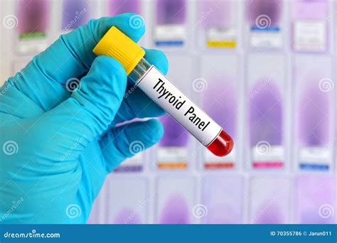 Thyroid panel test stock photo. Image of hospital, laboratory - 70355786