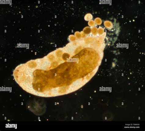 Phylum Platyhelminthes Tapeworm