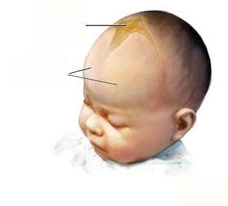 宝宝的头变畸形了？也许是患上了狭颅症-刘星宇的博客-KQ88口腔博客