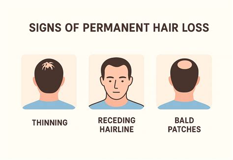 How to Identify Permanent Hair Loss: Key Signs & Symptoms