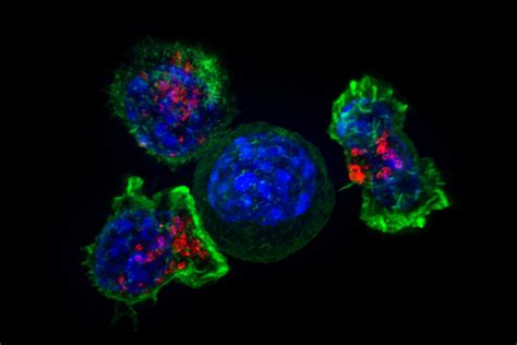 Cancer metabolism: finding how fast-growing cancers get their energy - Cancer Research UK ...