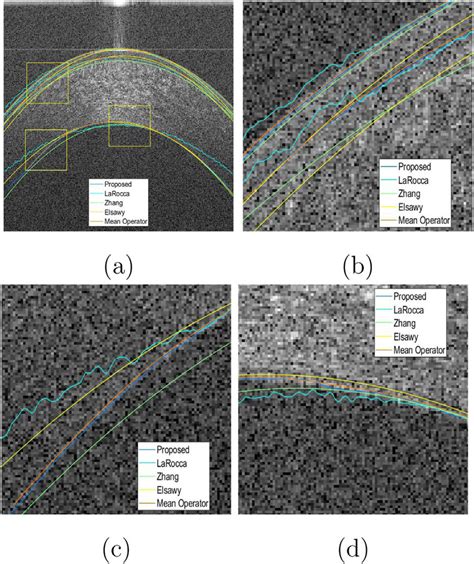Image result for Segmentation Methods