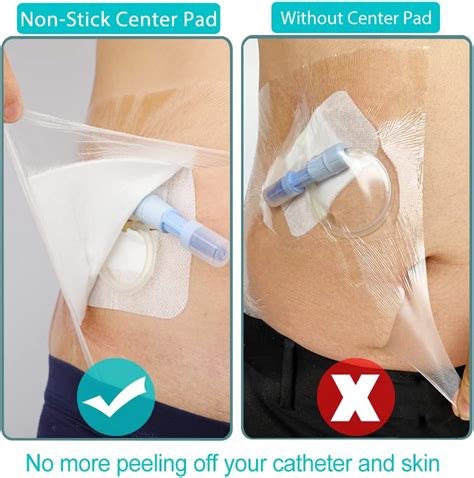 POSTOPMEDICALWEAR 25 Pcs Waterproof PD Dialysis Catheter Wound Cover ...