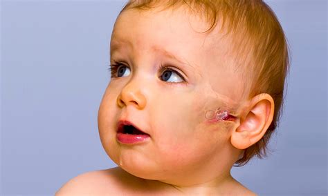 Ear Infection In Babies