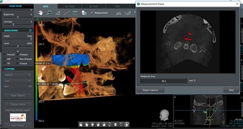 Buy Vatech PaX-i 3D CB CITY Online at Best Prices - ID Enterprises