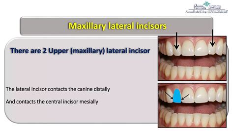 4= Permanent ‏Maxillary lateral incisor.pptx