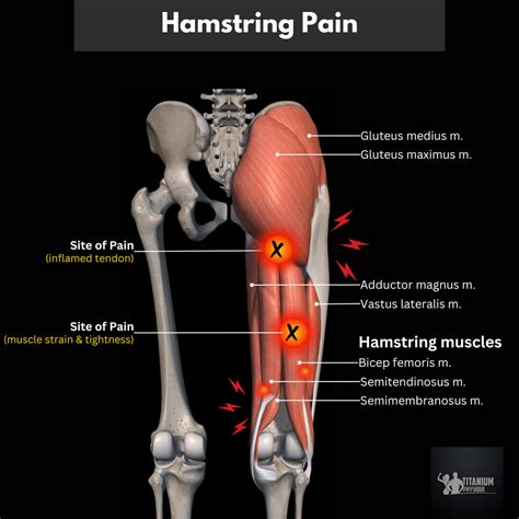 Lower Back Pain | Root Causes and Relief Exercises