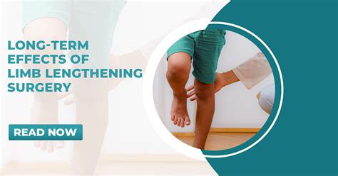 Long-Term Effects of Limb Lengthening Surgery