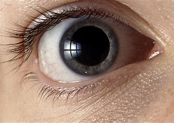 Image result for Extremely Large Iris Eye