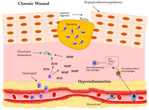 Wound Healing Properties of Natural Products: Mechanisms of Action