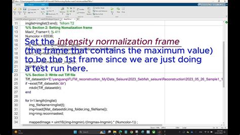 Microscope Image Processing 的图像结果