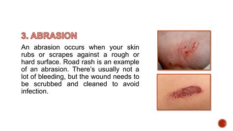 Dressing Surgical Wounds, Abrasion and Lacerations | PPTX