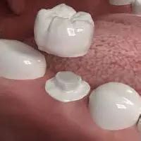 Best Dentist & Dental Clinic in Delhi | Dental Solutions