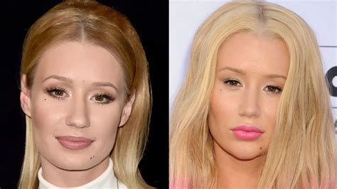 Iggy Azalea Plastic Surgery Explained Before After 2018 Iggy Azalea
