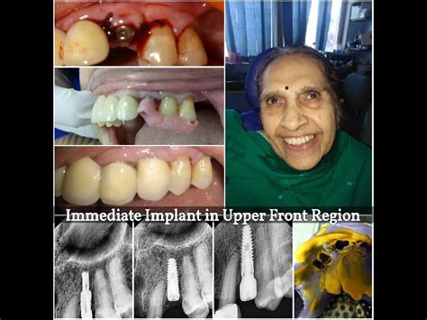 Treatments - Auora ENT Hospital And Dental Clinic