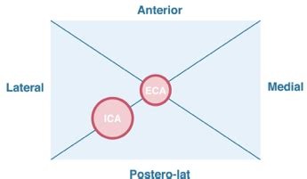 Image result for Examples of String Code