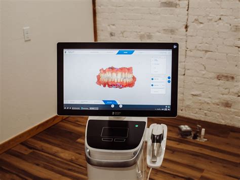 Implant Dentures | Fancher Family Dentistry