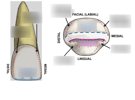 Line Angle Teeth 的图像结果