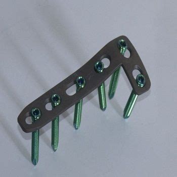 Orthopedic Locking Plates - 4.5 mm Locking L Buttress Plate ...