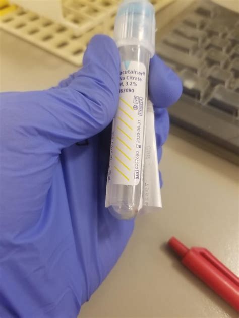 Image result for Epic Beaker Lab Module