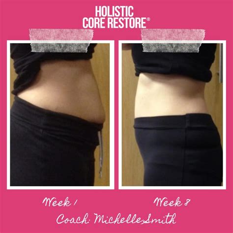 Belly Bandit Diastasis Recti at Roxann Donahue blog