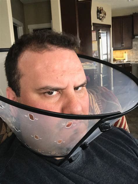 Vasectomy Gone Wrong