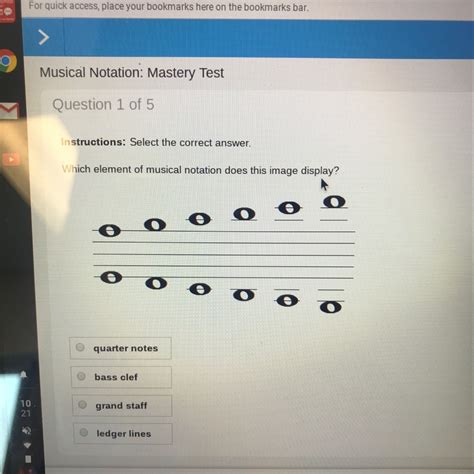 Which element of musical notation does this image display ? - brainly.com
