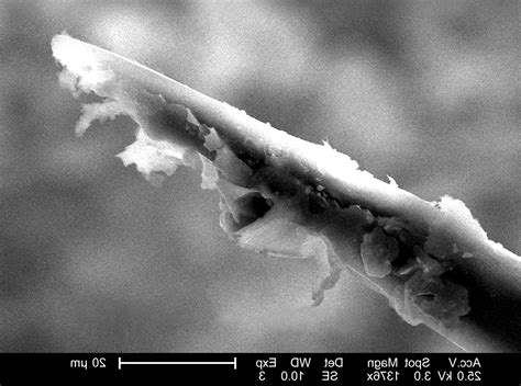 Microscopic Insects 的图像结果