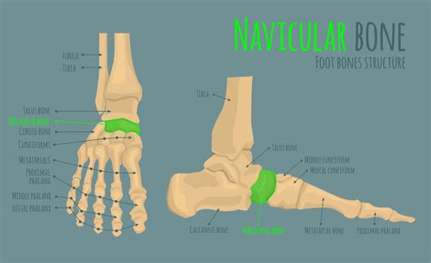 Accessory Navicular Bone Navicular Bone Wikipedia