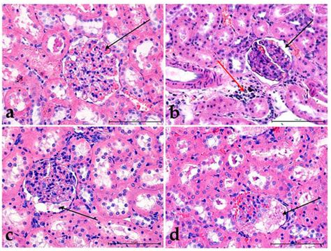 The Effect of Ilex × meserveae S. Y. Hu Extract and Its Fractions on ...