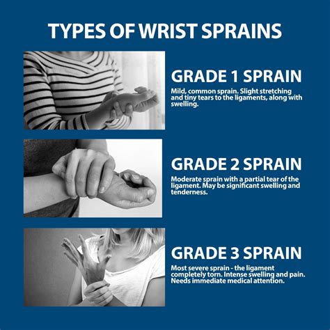What are the symptoms of a wrist sprain? | Orthopaedics Toronto - OrthoTO