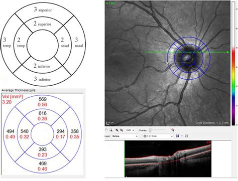 Image result for Relative Volume TOS Scan