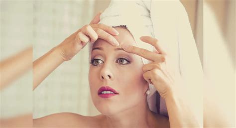 10 best remedies to get rid of whiteheads