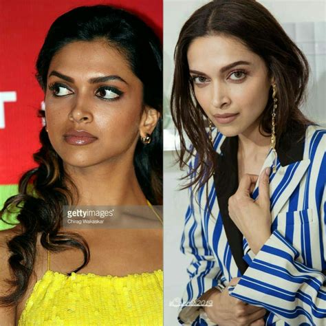 Deepika Padukone Face Surgery