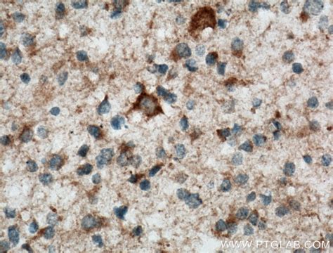 STOML1 antibody (12862-1-AP) | Proteintech