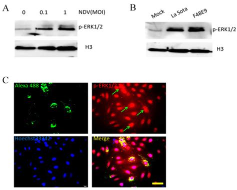 Newcastle Disease Virus V Protein Promotes Viral Replication in HeLa ...