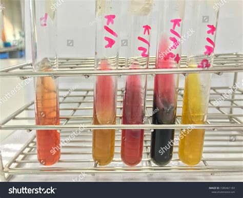 Triple Sugar Iron Tsi Test Microbiological Foto Stok 1580461183 ...