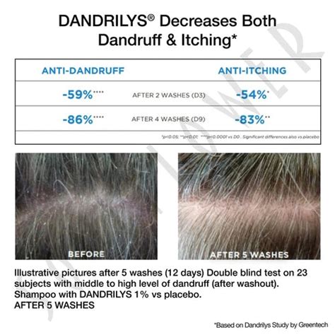 Buy Best Anti Shedding Dandruff Shampoo for Women & Men Online ...
